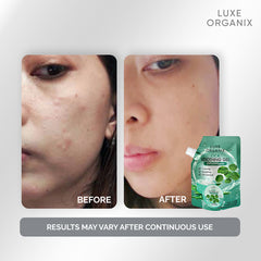Luxe Organix Cica Soothing Gel – 100ml
