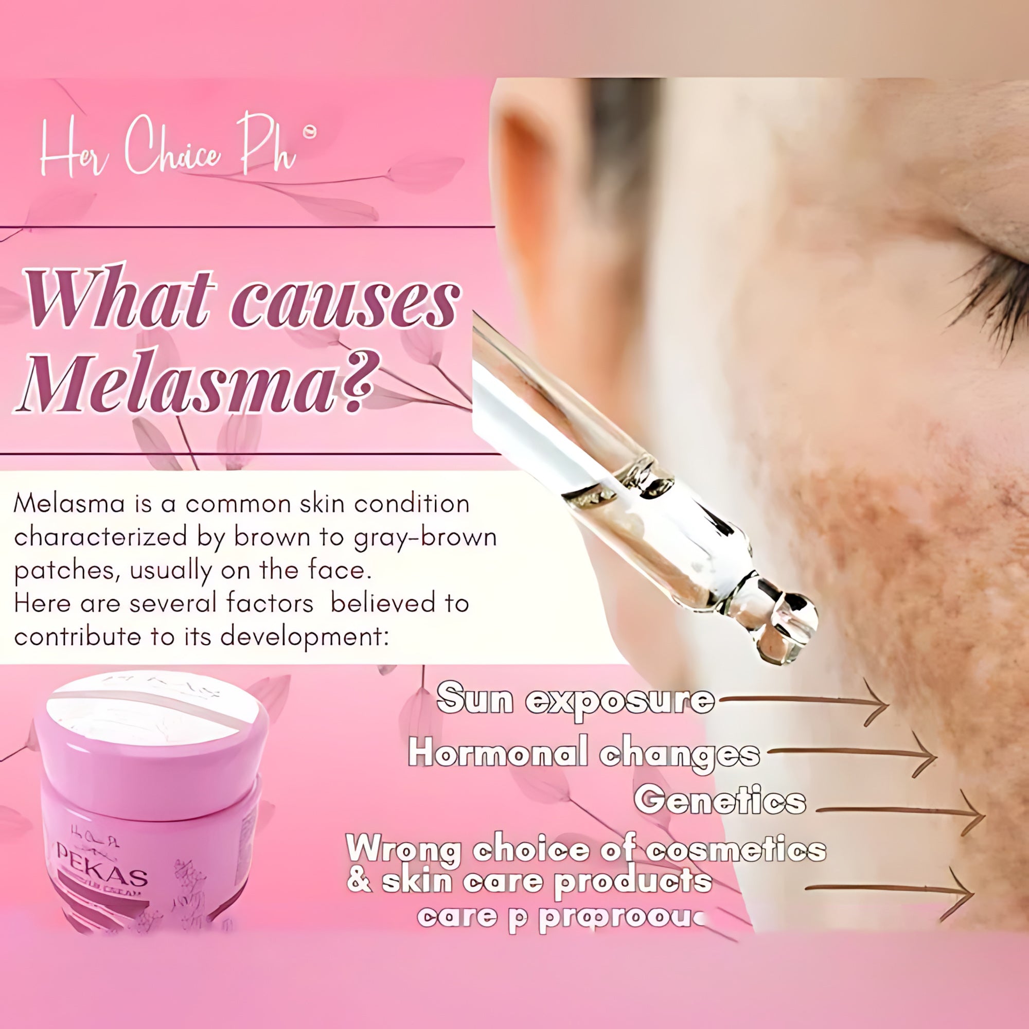 Her Choice Ph Pekas Remover Cream - 50g