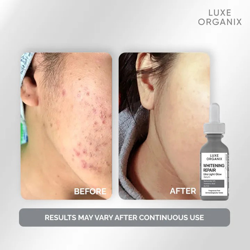 Luxe Organix Whitening Repair Ultra Light Glow Serum – 30ml