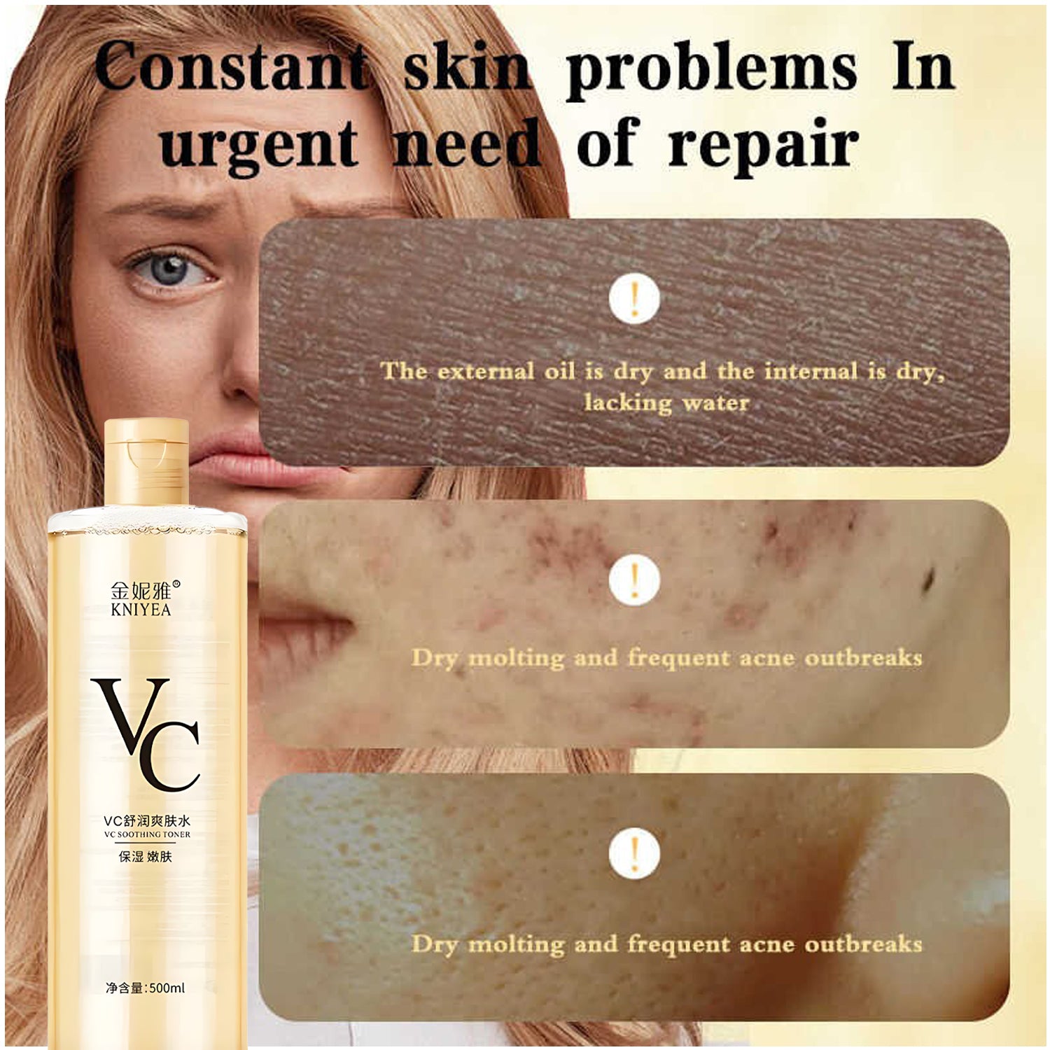 2 Kniyea VC Toner - 500ml + Sunscreen Free