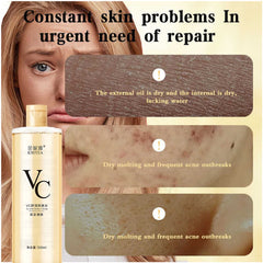 2 Kniyea VC Toner - 500ml + Sunscreen Free