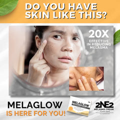 2NE2 MelaGlow Melasma Soap – 100g