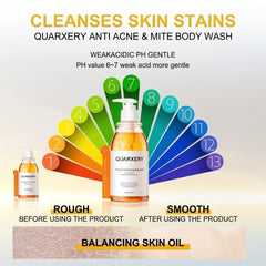 Quarxery Mite & Acne Cleansing Body Wash – 250ml