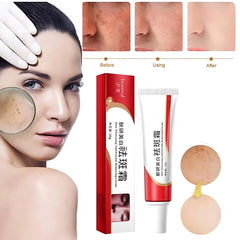 Houmai Skin Whitening & Freckle Removing Cream – 20g