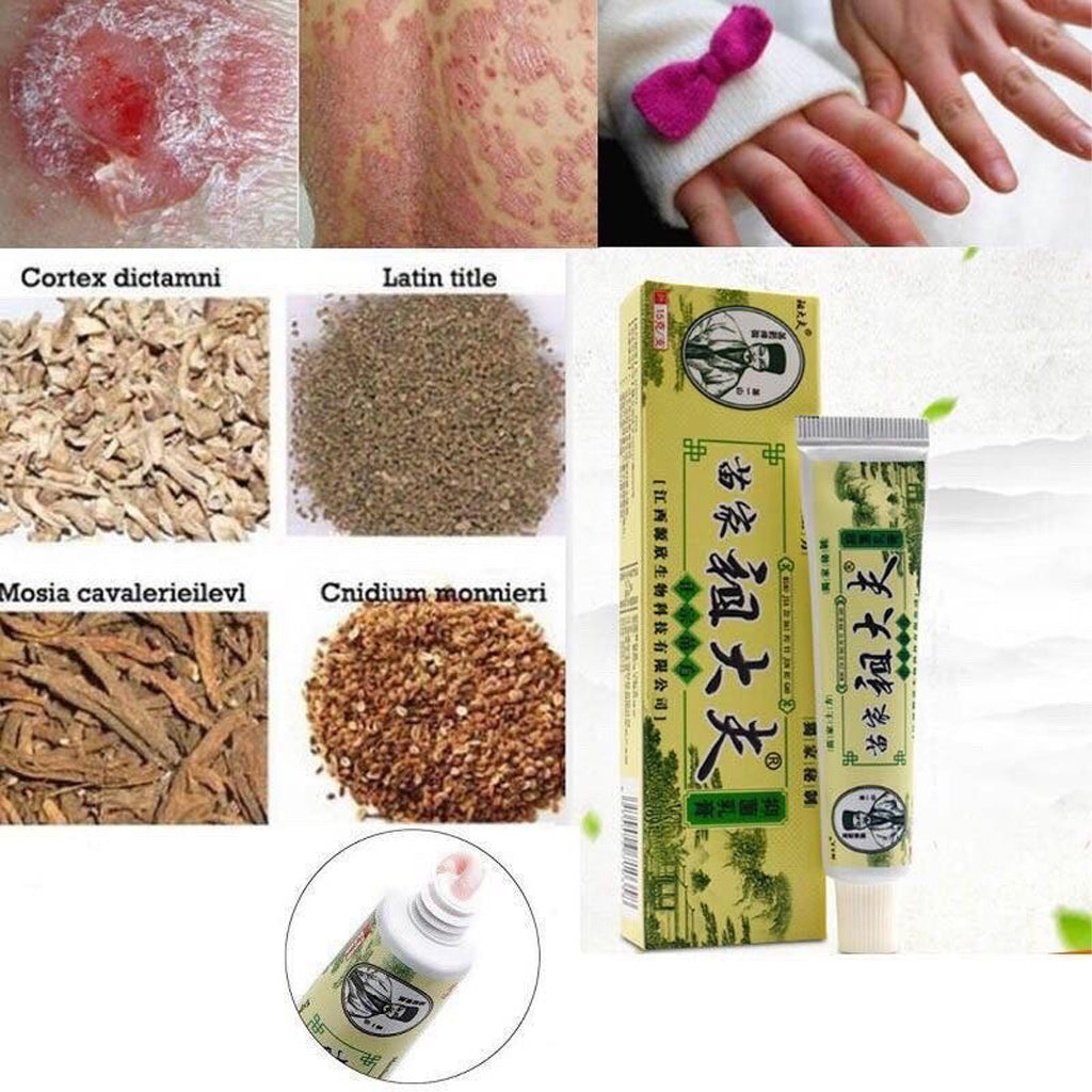 Miaojia Zudaifu Antibacterial Cream – Authentic Miao Formula (15g)