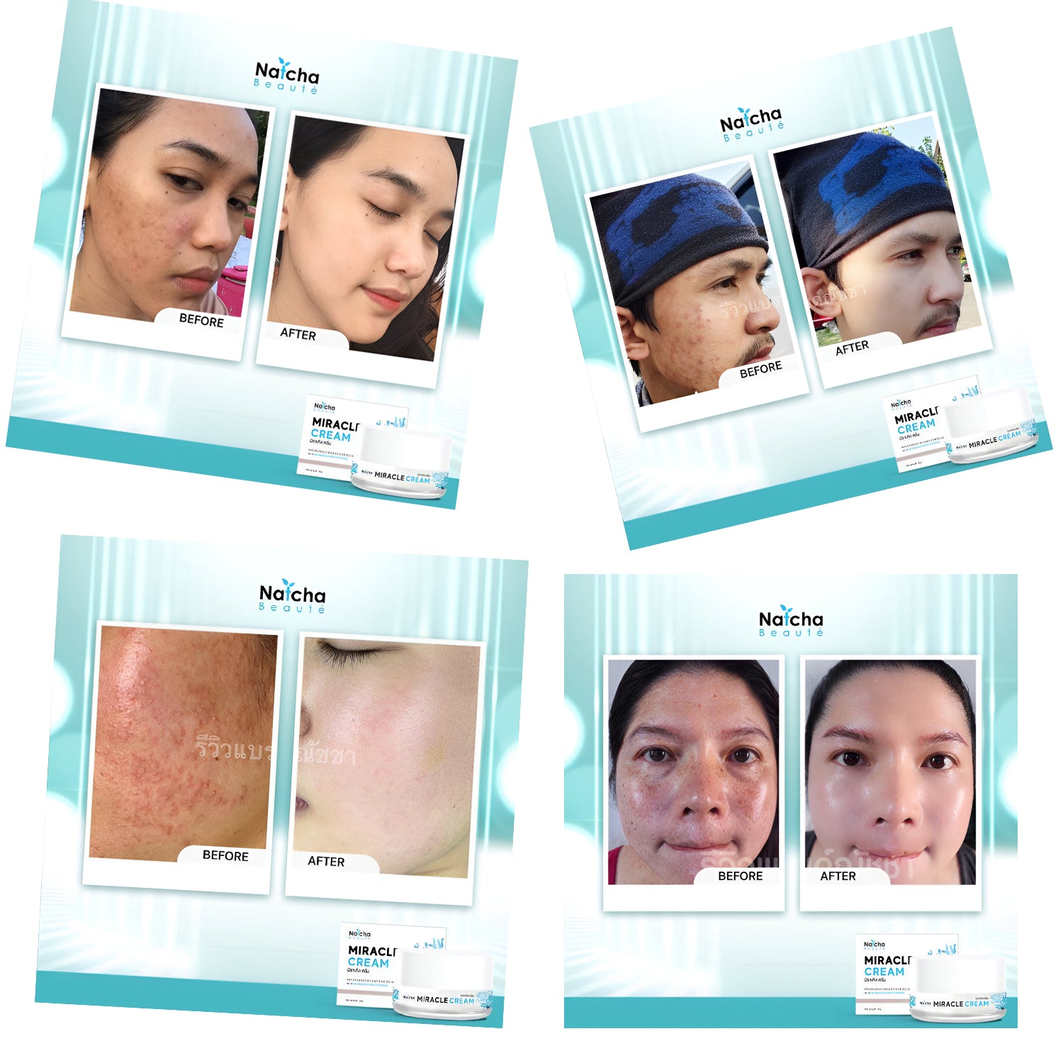 Natcha Beaute Miracle Cream -18g