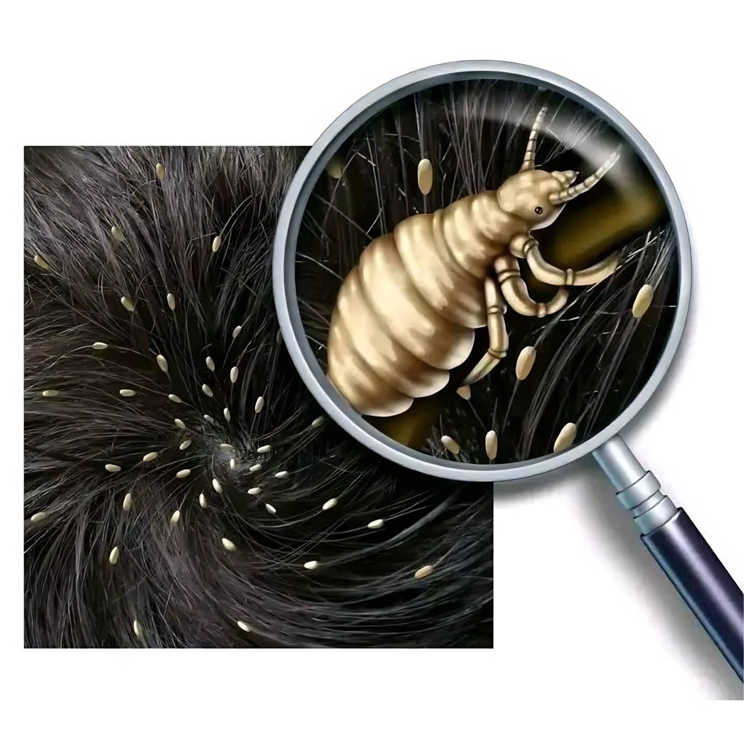 Disaar Lice Repellent Hair Oil – Natural Lice Defense & Scalp Treatment