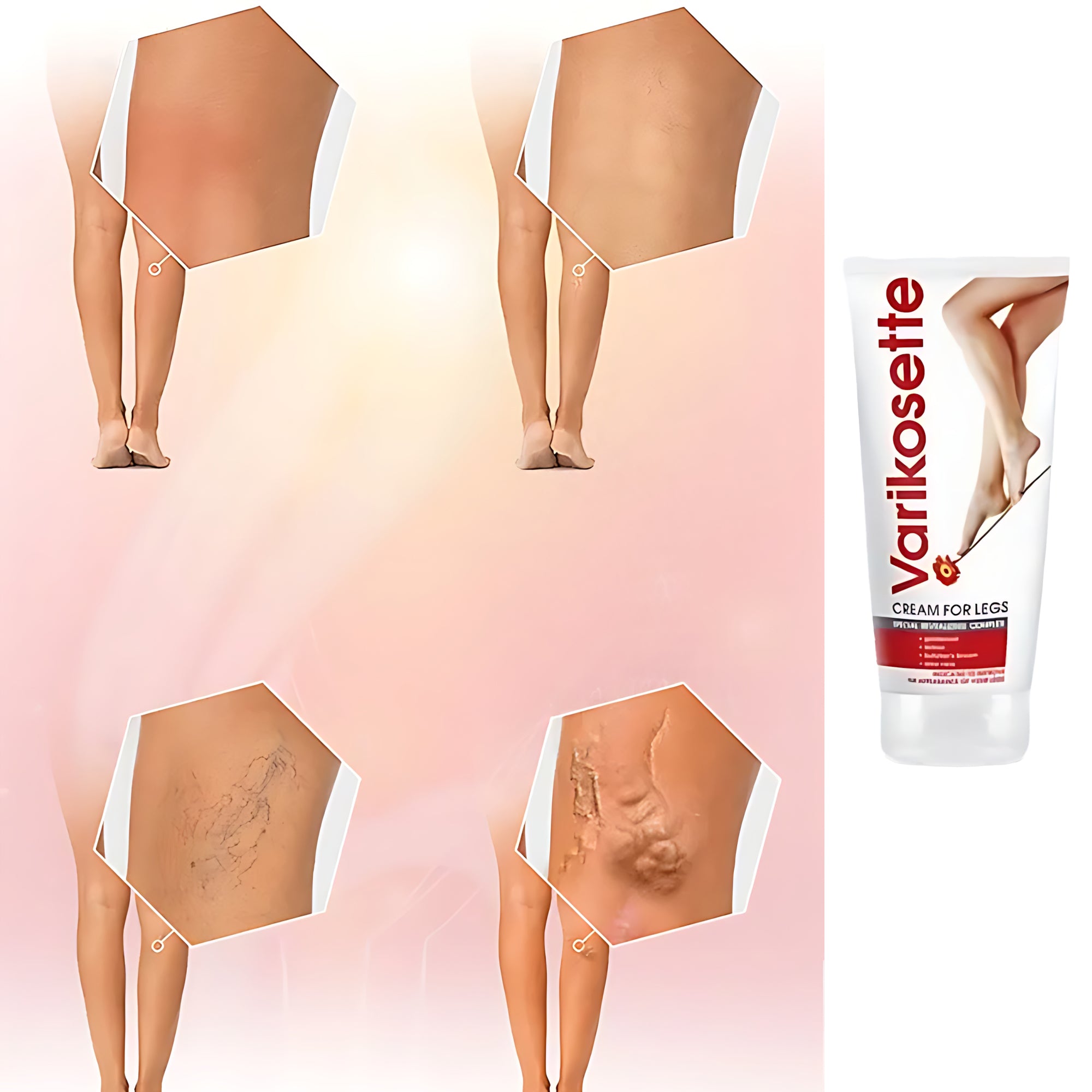 Varikosette Cream for Legs - 75ml