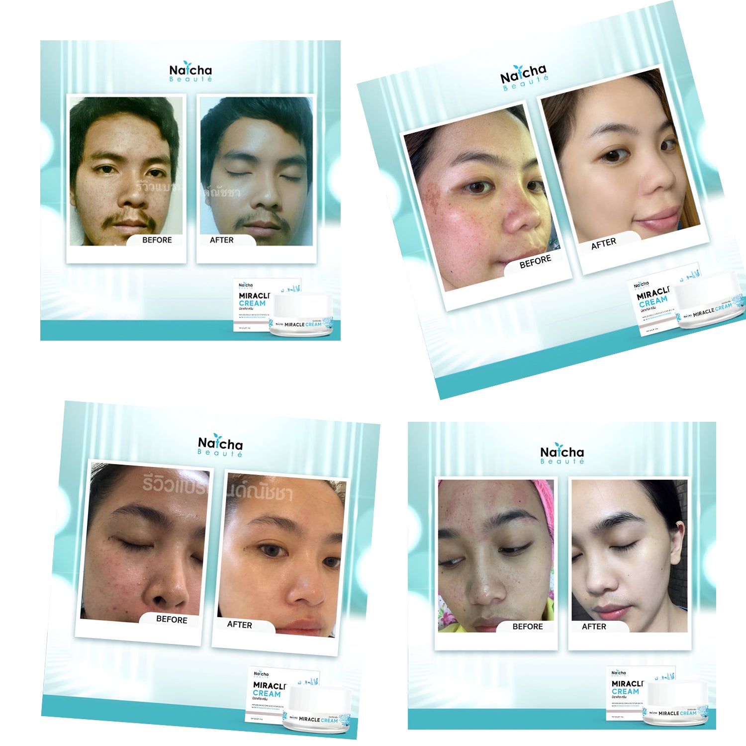 Natcha Beaute Miracle Cream -18g