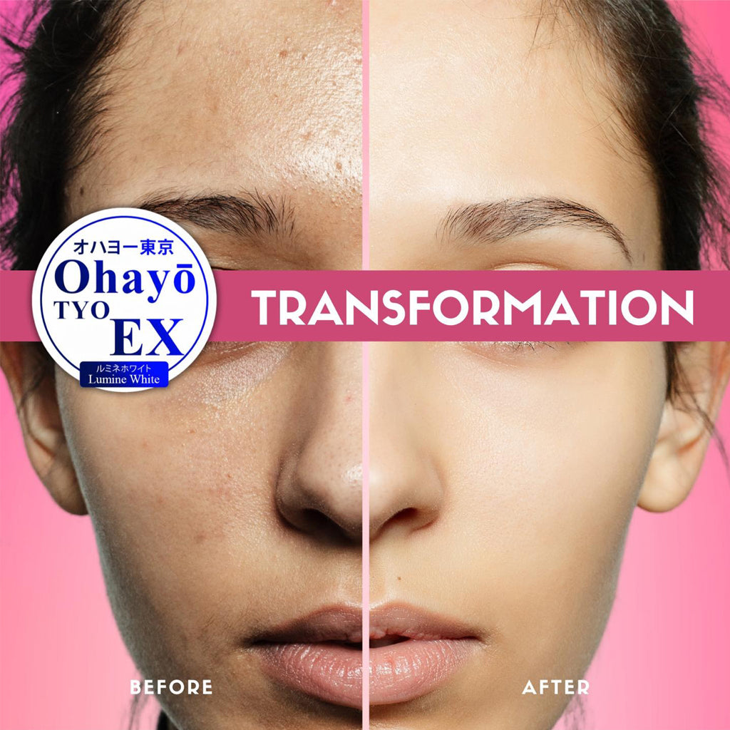 Ohayo Tyo EX Lumine White Glutathione 700mg 60 Cap Sige Mart UAE Ohayo Tyo EX Lumine White Glutathione 700mg 60 Cap Sige Mart UAE