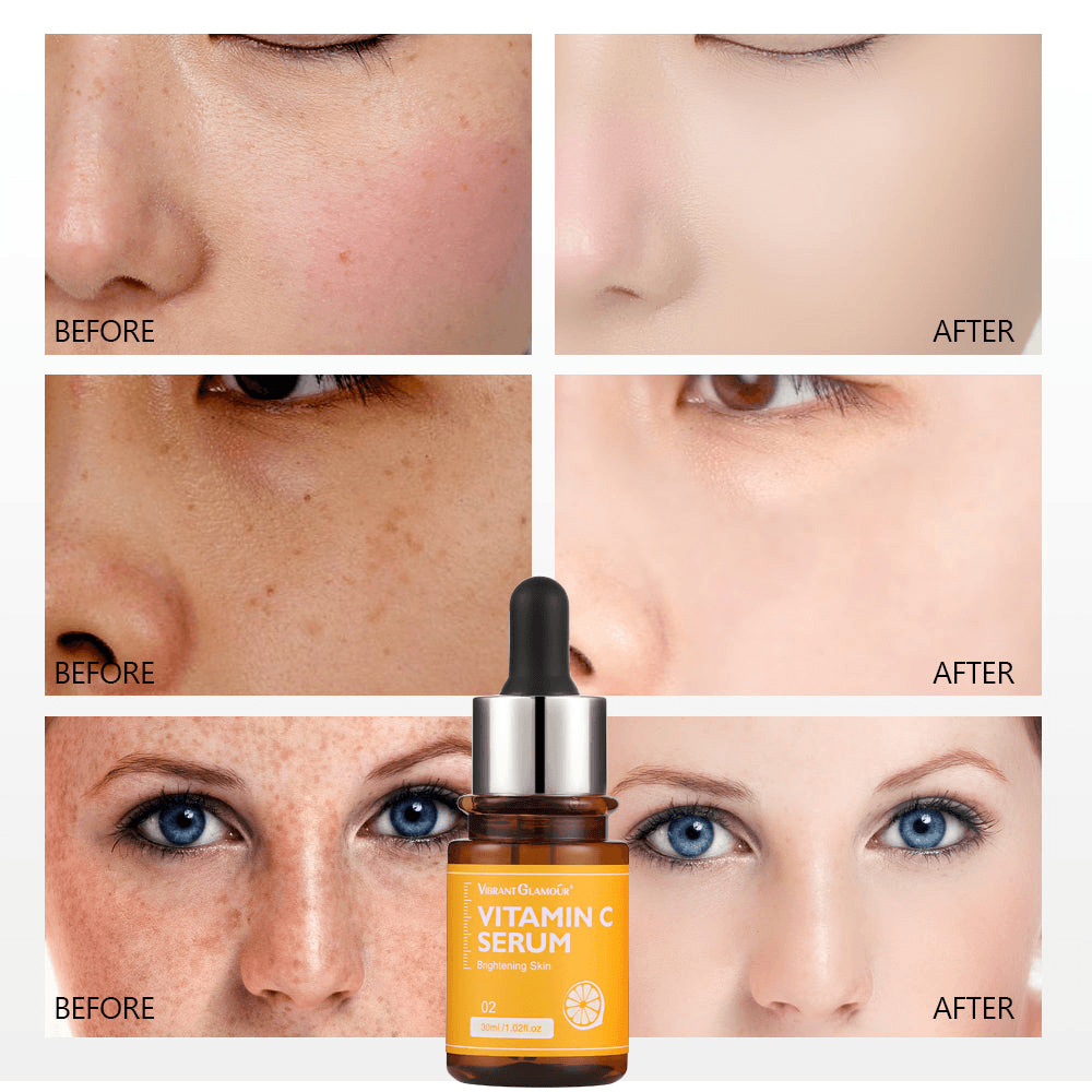 Vibrant Glamour Brightening Vitamin C Serum - 30ml - Pinoyhyper