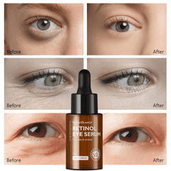 VIBRANT GLAMOUR Retinol Eye Serum - 30ml - Pinoyhyper